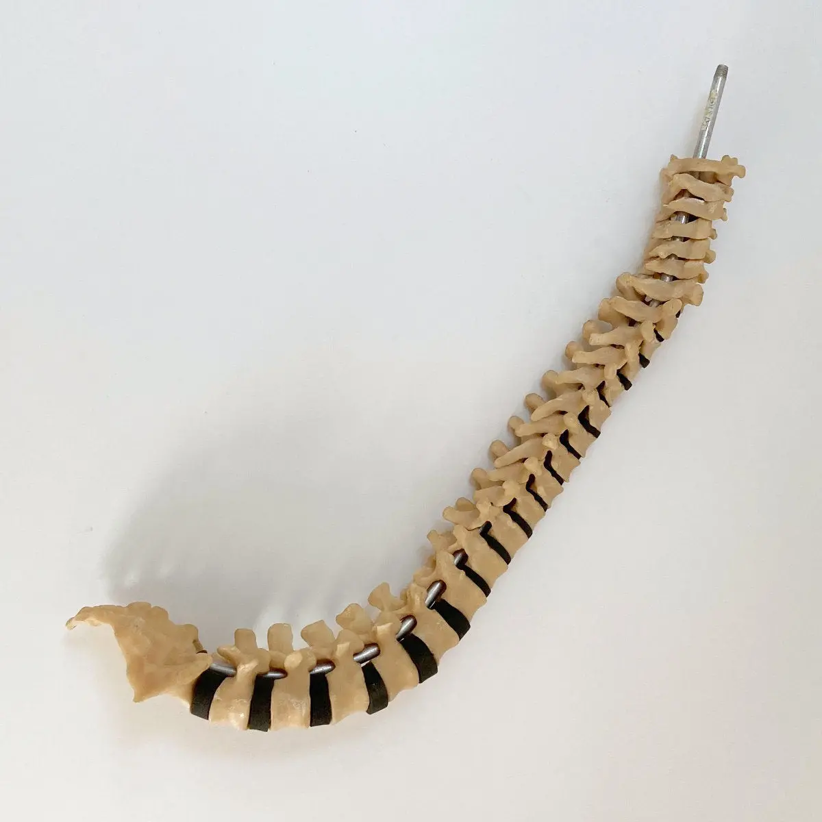 Scoliosis Spinal Column Model By Educational & Scientific Plastics Ltd 1