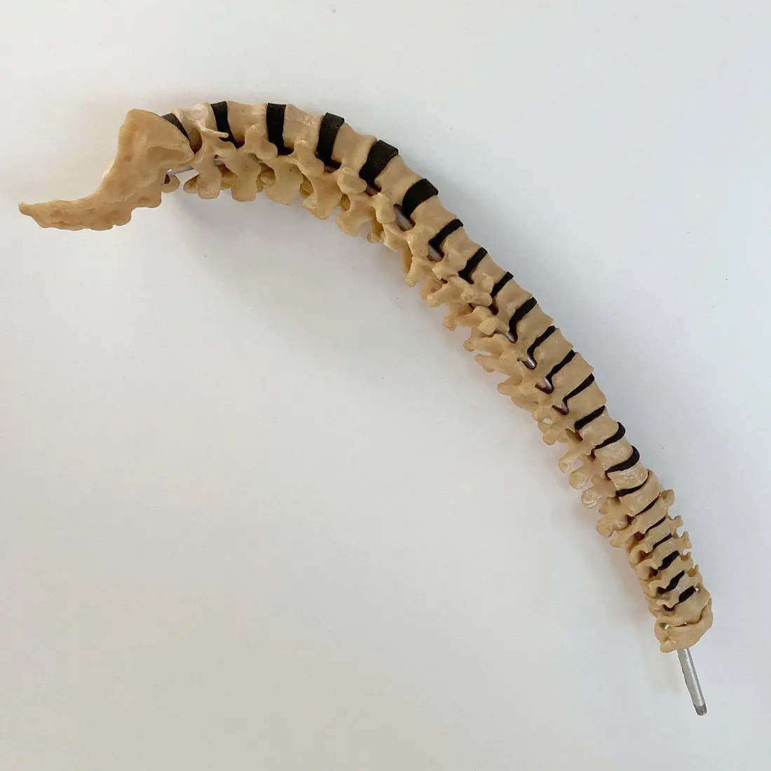 Scoliosis Spinal Column Model By Educational & Scientific Plastics Ltd 2