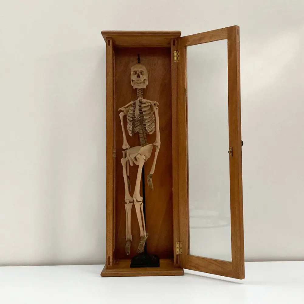 Tabletop Anatomical Skeleton In Case By Educational & Scientific Plastics Ltd 1